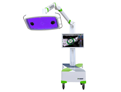 3DナビゲーションシステムX-Guideの導入