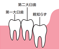 正常に生えているタイプ